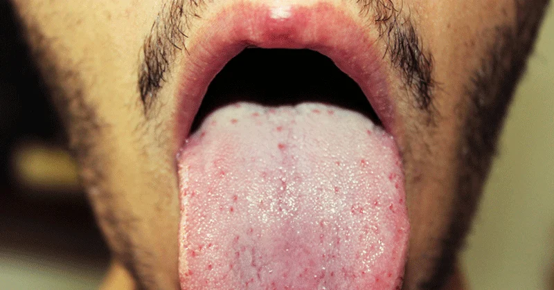 10 Simple Health Checks You Can Do At Home — Healthdigezt.com