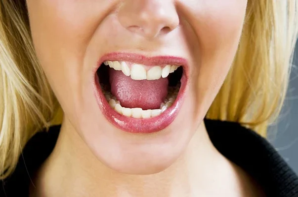 Exploding Mouth Everything You Need to Know About Burning Mouth Syndrome — Healthdigezt.com