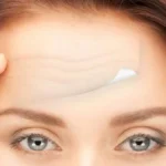 5 Things You Should Know to Reduce Forehead Lines or Wrinkles Homepage