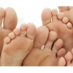 How to Deal With Ingrown Toenails Homepage