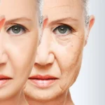 Natural Remedies for Saggy Skin Homepage