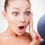 Easy DIY Acne Treatments Homepage