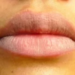 DIY Home Remedies To Lighten Dark Lips Homepage