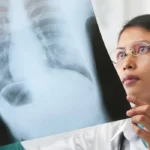 New Method of Detecting Lung Cancer Homepage