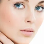 The No Acne Diet Homepage