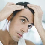 Hair Growth Vitamins for Men Homepage