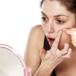 Good To Know Tips Before Going On An Acne Popping Spree Homepage