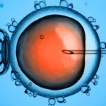 Facts about In-Vitro Fertilization (IVF) and Intra-Cytoplasmic Sperm Injection (ICSI) Homepage
