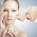 What Your Dry Skin Patches Says About You Homepage