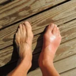 Foot Pain: An Overview on Causes, Symptoms, Diagnosis, and Treatment Homepage