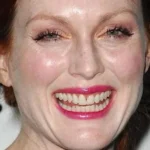 Here are Effective Ways to Prevent your Gums from Receding Homepage