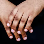 Home Remedies to Lighten Dark Knuckles Homepage