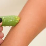 Tips on How to Treat Chafed Skin Naturally Homepage