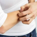 Natural Remedies for Skin Itching Homepage