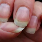 Quick Fixes for Common Nail Problems Homepage