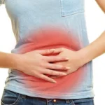 Irritable Bowel Syndrome What is it? Homepage