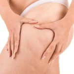 Remove Cellulite Using Natural Remedies Homepage