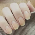 Yellow Nails: Facts and Home Remedies Homepage