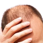 Signs That You Need to Get More Zinc Homepage