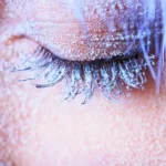 Frostbite Causes and Symptoms Homepage