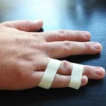 Home Remedies for a Jammed Finger Homepage