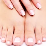 Natural Remedies for Nail Discoloration Homepage