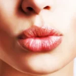 How to Plump Your Thin Lips Naturally Homepage