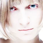 Paleness Causes and Associates Symptoms Homepage