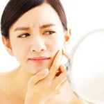 Banish Scars Naturally Homepage