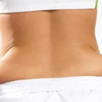 Remove Back Fat Fast at Home Homepage