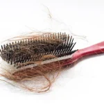Foods to Eat If You’re Losing a Lot of Hair Homepage