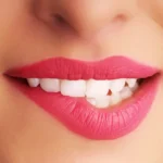Home Remedies for Uneven Color of the Lips Homepage