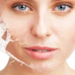 Make Your Own Chemical Skin Peel Homepage