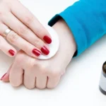 Tea Tree Oil Remedies for Various Skin Conditions Homepage