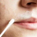 Remove Facial Hair Using Russian Home Remedy Homepage