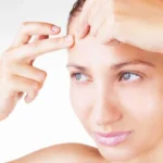 Forehead Acne: Common Causes and Effective Home Remedies Homepage