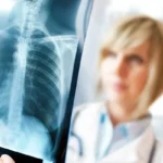 Things That Increase Your Risk of Pneumonia Homepage