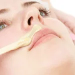 Remove Upper Lip Hair Naturally Homepage