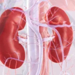 Chronic Kidney Disease: Everything You Need to Know About It Homepage