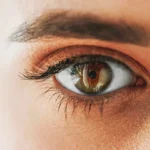 Keratomalacia: An Eye Condition Due to Vitamin A Deficiency Homepage