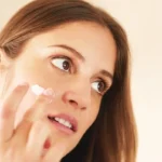 Home Remedies for Acne You Probably Didn’t Know About Homepage