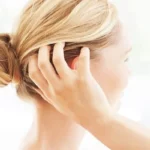 Lesser-Known Home Remedies for Itchy Scalp Homepage