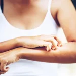 Alleviate Heat Rash with These Essential Oils Homepage