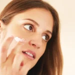 Home Remedies for Redness of Acne and Acne Scars Homepage