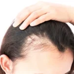 Essential Oils for Hair Loss in Women Homepage