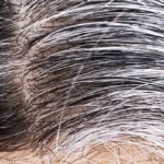 How to Remove White Hair Naturally Homepage