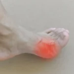 Common Causes of Pain in the Big Toe Joint Homepage