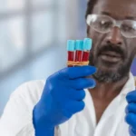 Common Causes of Blood in Urine Homepage